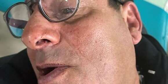 العزيز مدرب الرشاد البرنوصي تعرض لحادث ورئيس النادي كيتهم مدرب سابق بالاعتداء عليه (تصاور)