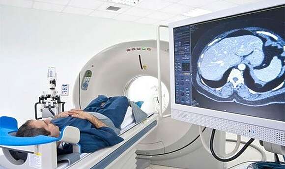الوخز بالإبر علاجًا آمنًا وفعالًا لمساعدة مرضى السكتة الدماغية على استعادة صوتهم