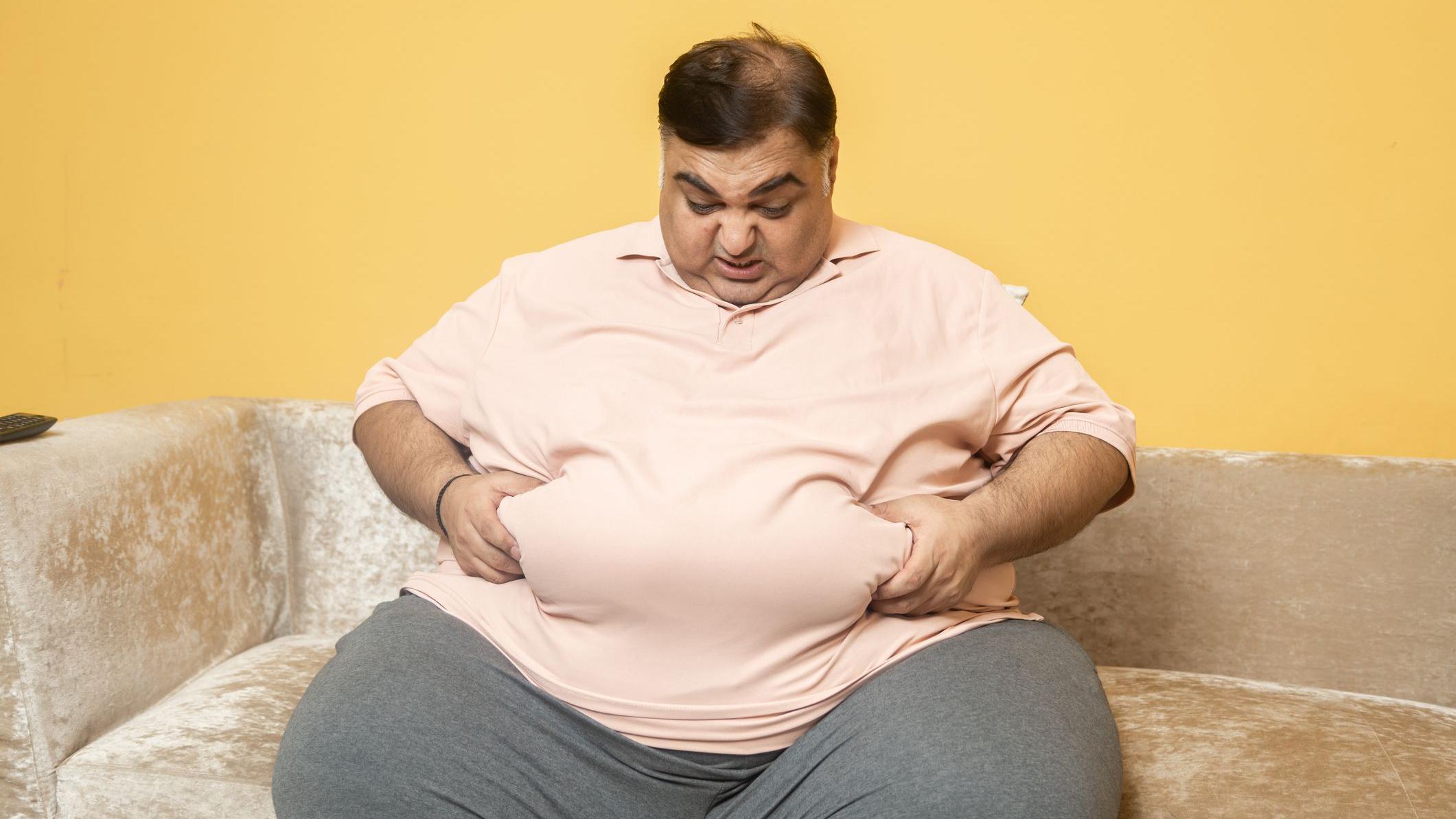 صورة لرجل مصاب بالسمنة